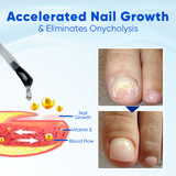MADE IN USA 🤩 OnyxoGuard Nail Growth and Repair Serum🔥